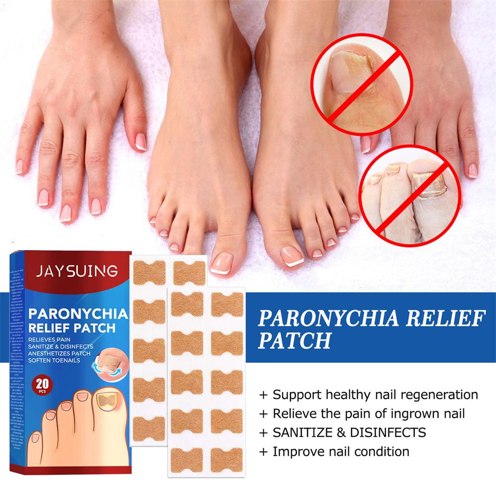 "Relieve Ingrown Toenail Discomfort with Our Specialized Patches"